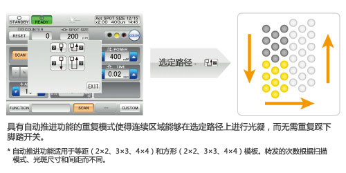 自動推進功能